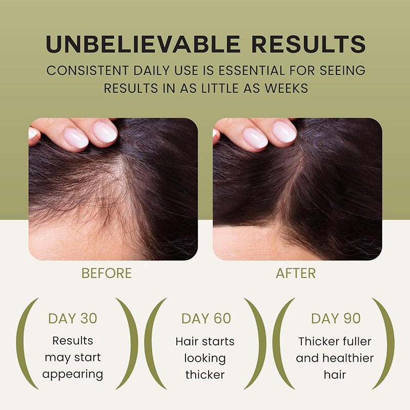🌿Louxlue Oil for Hair Growth (BOGO) - 100% Pure, Raw & Natural Haircare Serum