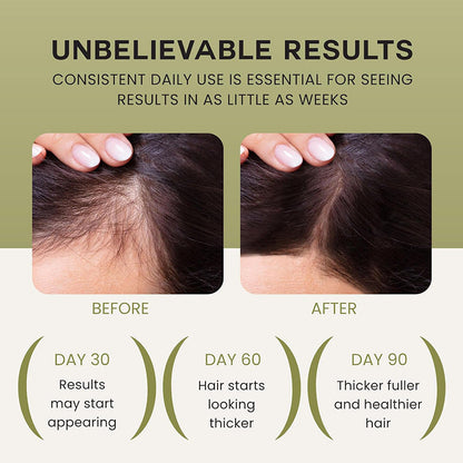 🌿Louxlue Oil for Hair Growth (BOGO) - 100% Pure, Raw & Natural Haircare Serum