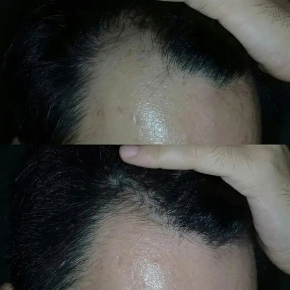 Deoxyribose Scalp Serum™