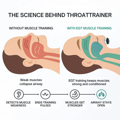 Louxglow® ThroatTrainer - The World's First System To Train Your Body To Stop Snoring