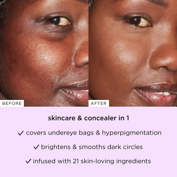 💜Luxgloe Shape Tape Concealer Duo – Brighten, Lift & Conceal + Free Pro Brush