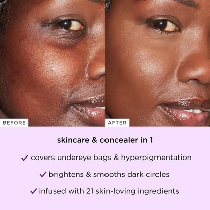 💜Luxgloe Shape Tape Concealer Duo – Brighten, Lift & Conceal + Free Pro Brush