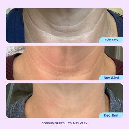 Luxgloe Miracle Neck Cream: Erase "Turkey Neck" & "Tech Neck" Lines Visible Lift & Smoothness in 4 Weeks