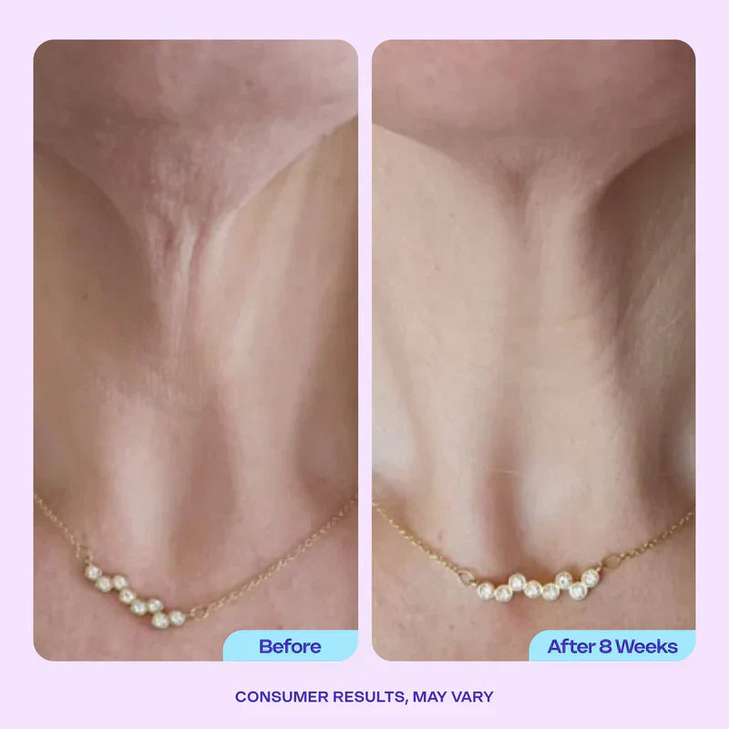 Luxgloe Miracle Neck Cream: Erase "Turkey Neck" & "Tech Neck" Lines Visible Lift & Smoothness in 4 Weeks