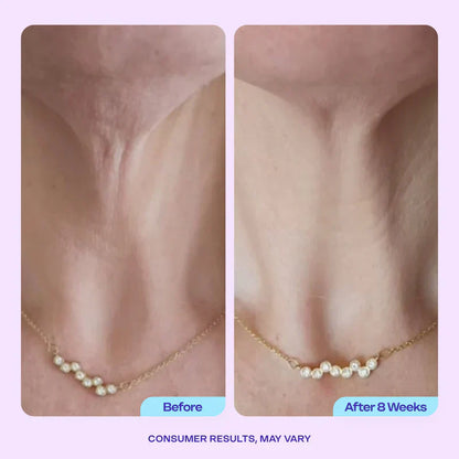 Luxgloe Miracle Neck Cream: Erase "Turkey Neck" & "Tech Neck" Lines Visible Lift & Smoothness in 4 Weeks